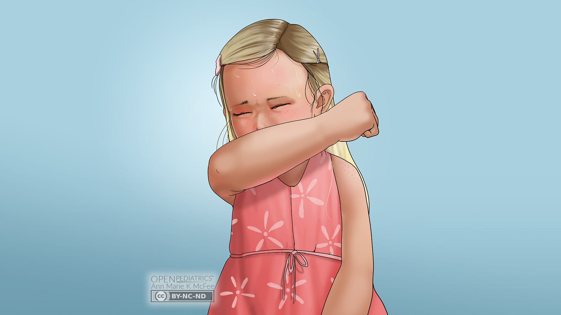 Child Coughing with Fever
